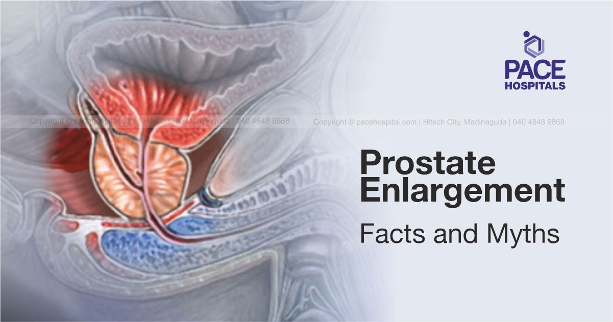 Prostate Enlargement Facts and Myths